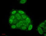 HSP27 Antibody in Immunocytochemistry (ICC/IF)