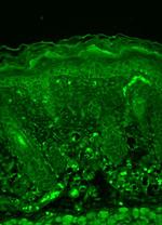 Rhodopsin Antibody in Immunohistochemistry (Paraffin) (IHC (P))