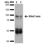 SCNN1B Antibody in Western Blot (WB)