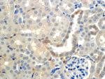 SCNN1B Antibody in Immunohistochemistry (IHC)