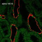 alpha-ENaC Antibody in Immunohistochemistry (Paraffin) (IHC (P))