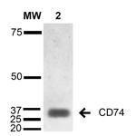 CD74 Antibody in Western Blot (WB)