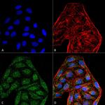 CD74 Antibody in Immunocytochemistry (ICC/IF)