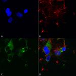 CaV1.3 Antibody in Immunocytochemistry (ICC/IF)