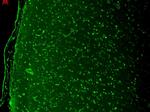 CaV1.3 Antibody in Immunohistochemistry (Paraffin) (IHC (P))