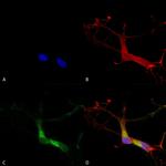 HCN1 Antibody in Immunocytochemistry (ICC/IF)