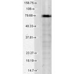 KCNQ1 Antibody in Western Blot (WB)