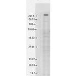 TRPM7 Antibody in Western Blot (WB)