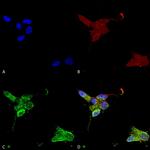 TRPM7 Antibody in Immunocytochemistry (ICC/IF)