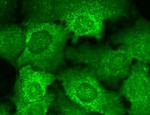 CACNB2 Antibody in Immunocytochemistry (ICC/IF)