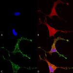 CACNB2 Antibody in Immunocytochemistry (ICC/IF)