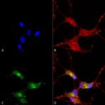 SHANK3 Antibody in Immunocytochemistry (ICC/IF)