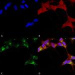 GABRB3 Antibody in Immunocytochemistry (ICC/IF)