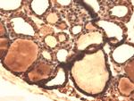 SLC5A5 Antibody in Immunohistochemistry (PFA fixed) (IHC (PFA))