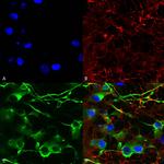 KCC2 Antibody in Immunocytochemistry (ICC/IF)