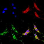 VGLUT2 Antibody in Immunocytochemistry (ICC/IF)