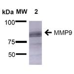 MMP9 Antibody in Western Blot (WB)