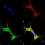 ATP7A Antibody in Immunocytochemistry (ICC/IF)