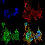 Ankyrin B Antibody in Immunocytochemistry (ICC/IF)