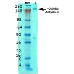 Ankyrin B Antibody in Western Blot (WB)