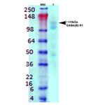 GABBR1 Antibody in Western Blot (WB)