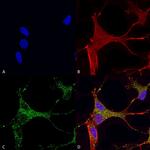 CaV3.1 Antibody in Immunocytochemistry (ICC/IF)