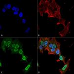 mGluR1/mGluR5 Antibody in Immunocytochemistry (ICC/IF)