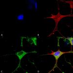 CLCN3 Antibody in Immunocytochemistry (ICC/IF)