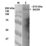 Dicer Antibody in Western Blot (WB)