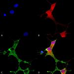 mGluR1/mGluR5 Antibody in Immunocytochemistry (ICC/IF)