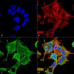 ASIC1 Antibody in Immunocytochemistry (ICC/IF)