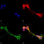 ASIC1 Antibody in Immunocytochemistry (ICC/IF)