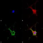 alpha-2c Adrenergic Receptor Antibody in Immunocytochemistry (ICC/IF)