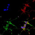 LRRK2 Antibody in Immunocytochemistry (ICC/IF)