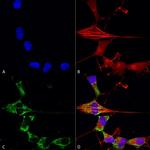 FGF13 Antibody in Immunocytochemistry (ICC/IF)