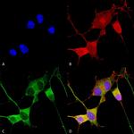 Ataxin 1 Antibody in Immunocytochemistry (ICC/IF)