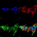 MFN2 Antibody in Immunocytochemistry (ICC/IF)