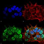 SHANK1/SHANK3 Antibody in Immunocytochemistry (ICC/IF)