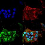 Ataxin 1 Antibody in Immunocytochemistry (ICC/IF)