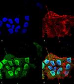 Ataxin 1 Antibody in Immunocytochemistry (ICC/IF)