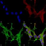 Spectrin beta-4 Antibody in Immunocytochemistry (ICC/IF)