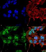 GABRA2 Antibody in Immunocytochemistry (ICC/IF)