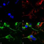 GABRA2 Antibody in Immunocytochemistry (ICC/IF)