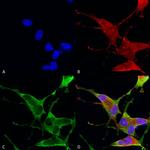 Ankyrin 1 Antibody in Immunocytochemistry (ICC/IF)