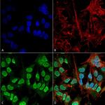 alpha Synuclein Antibody in Immunocytochemistry (ICC/IF)