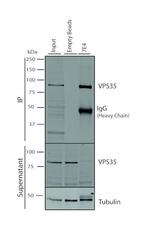 VPS35 Antibody in Immunoprecipitation (IP)