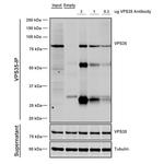 VPS35 Antibody in Immunoprecipitation (IP)