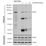 VPS35 Antibody in Immunoprecipitation (IP)