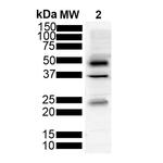 Tau Antibody in Western Blot (WB)