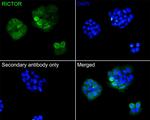 RICTOR Antibody in Immunocytochemistry (ICC/IF)